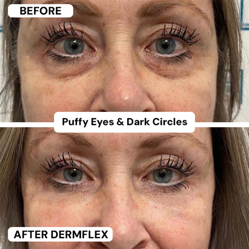 DermFlex - Wrinkle Eraser