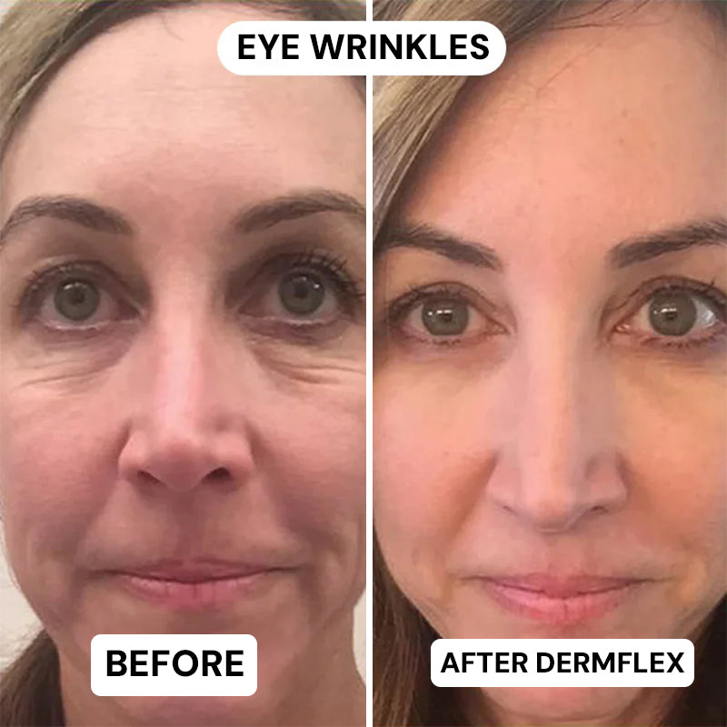DermFlex - Wrinkle Eraser