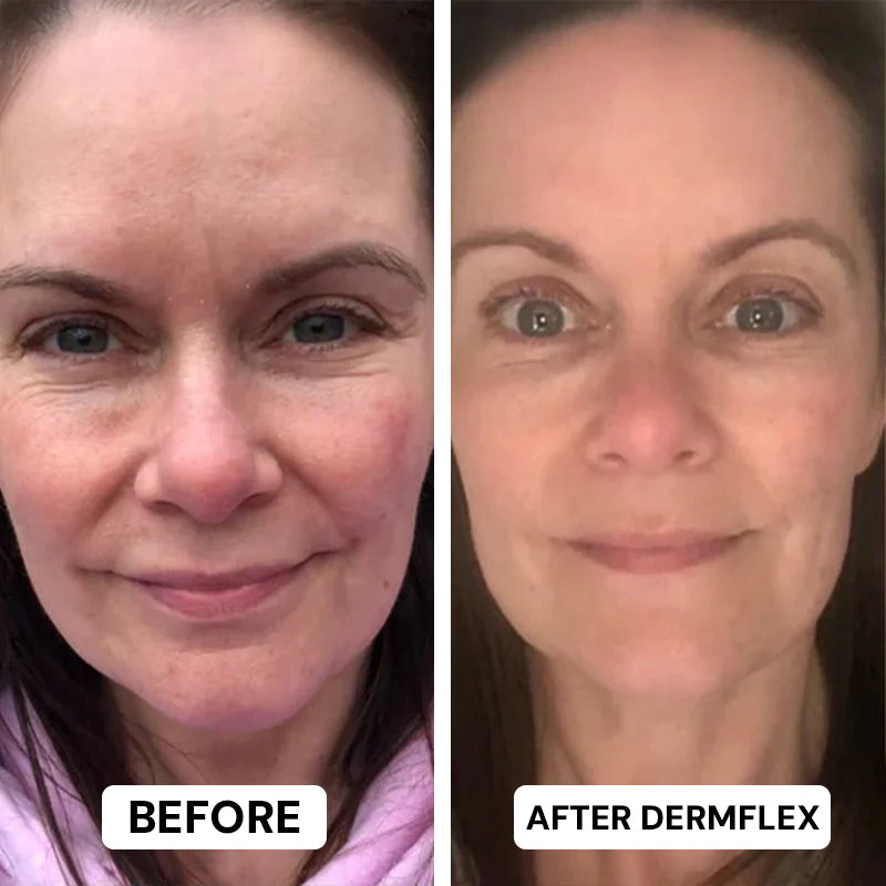 DermFlex - Wrinkle Eraser