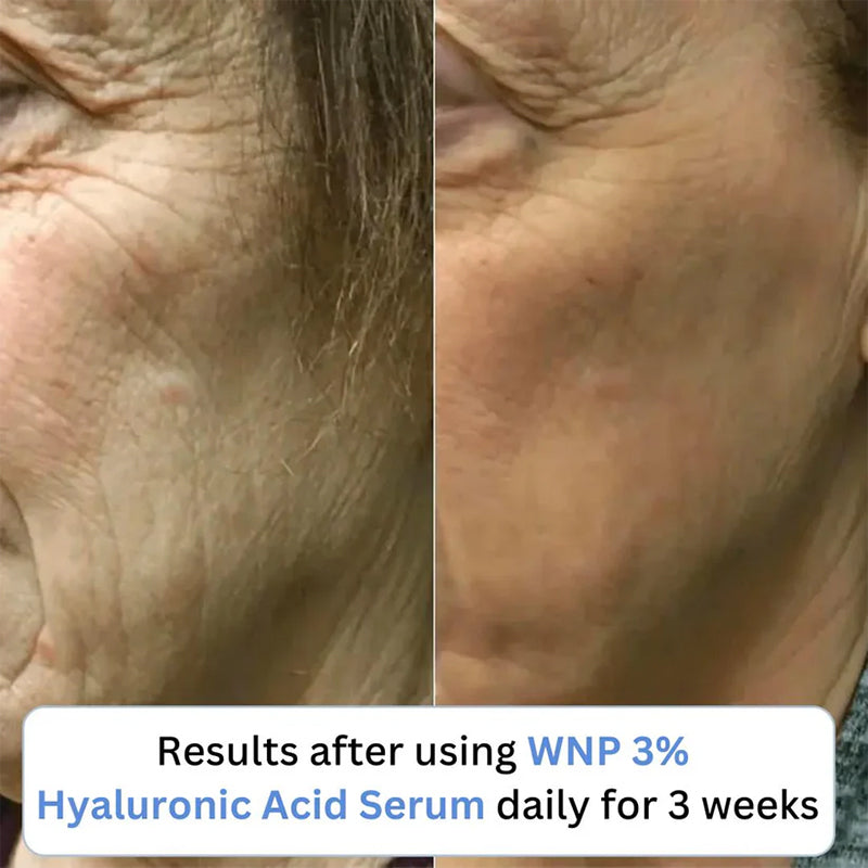 3% Ultra Hydrating Hyaluronic Acid Serum