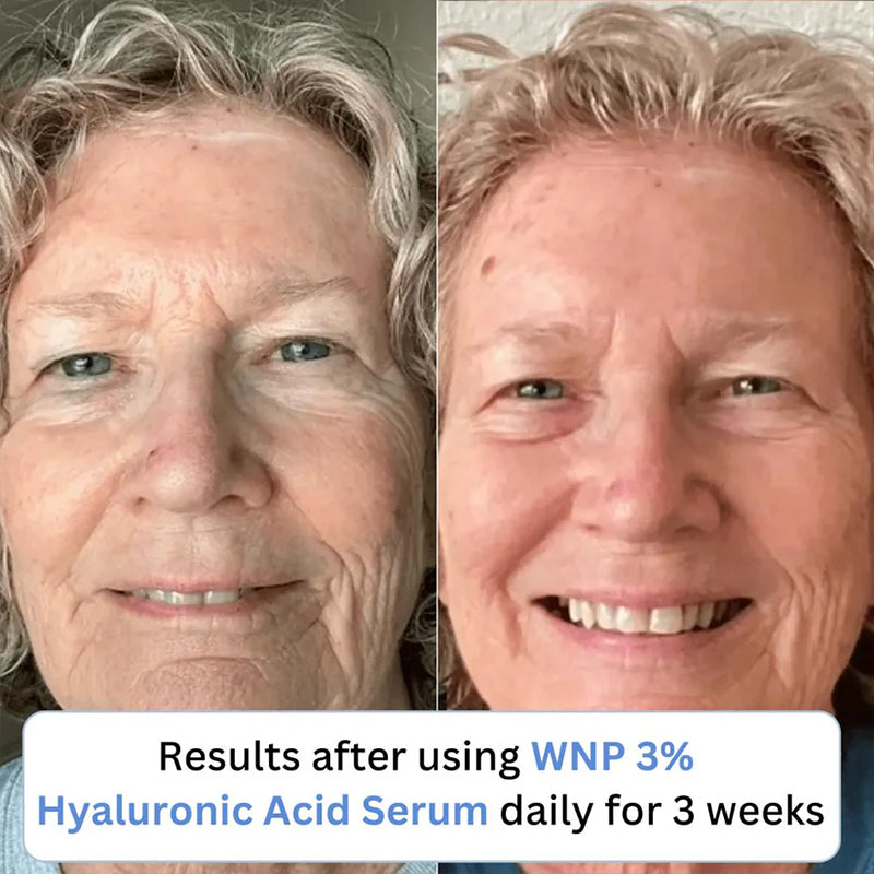 3% Ultra Hydrating Hyaluronic Acid Serum