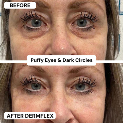 DermFlex - Wrinkle Eraser