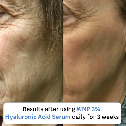 3% Ultra Hydrating Hyaluronic Acid Serum