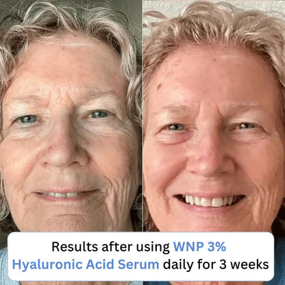 3% Ultra Hydrating Hyaluronic Acid Serum