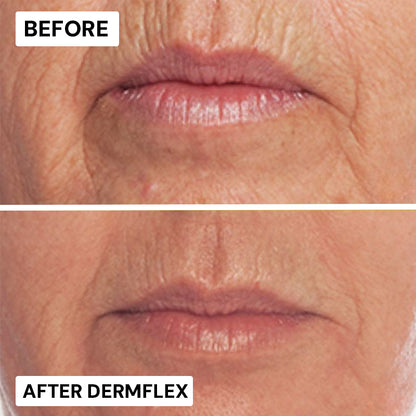 DermFlex - Wrinkle-Eraser