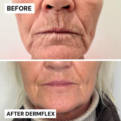 DermFlex - Wrinkle-Eraser